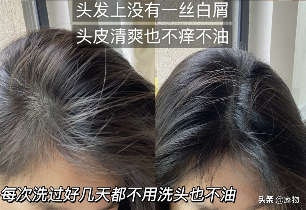 硫磺皂冼头好吗_硫磺皂洗头还用洗发水吗_